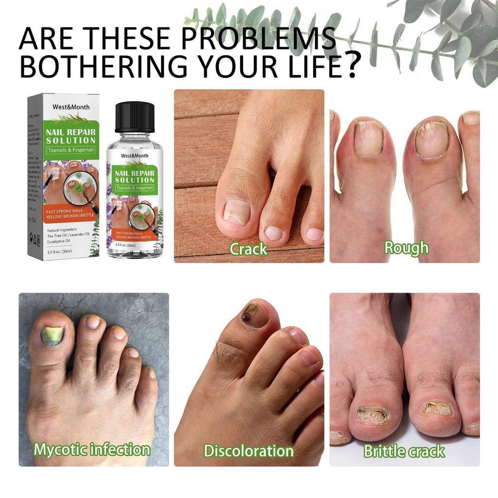 Lotion antifongique pour ongles